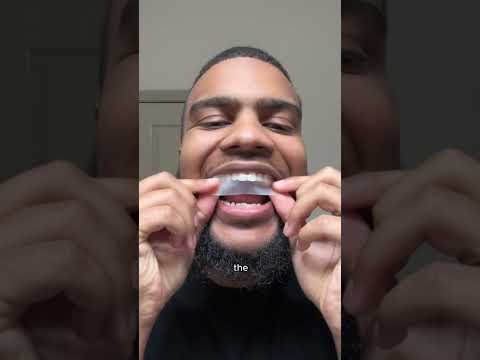 How to put on MySmile teeth whitening strips? #mysmile #teethwhitening #teethwhiteningstrips