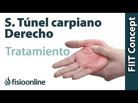 ¿Cómo se cura el túnel carpiano sin cirugía? ¿Cómo se cura el túnel carpiano sin cirugía?