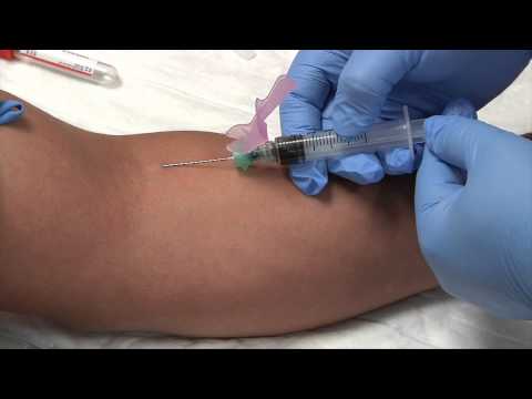 抽血術。注射器拔管程序 (Phlebotomy: Syringe Draw Procedure)