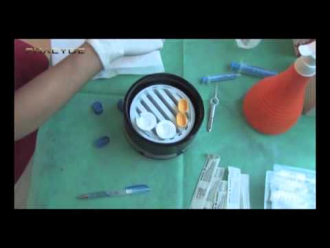 Wypadanie włosów przy podejmowaniu ursosan Maska do włosów z kawy i koniaku receptury
