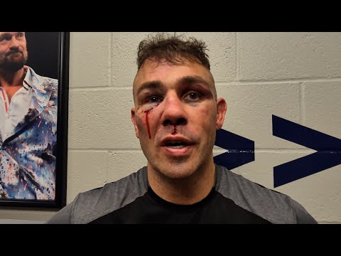 BRUISED & CUT Matty Floyd AFTER JAMES DEGALE BAREKNUCKLE DEFEAT: 'I THOUGHT I WON!