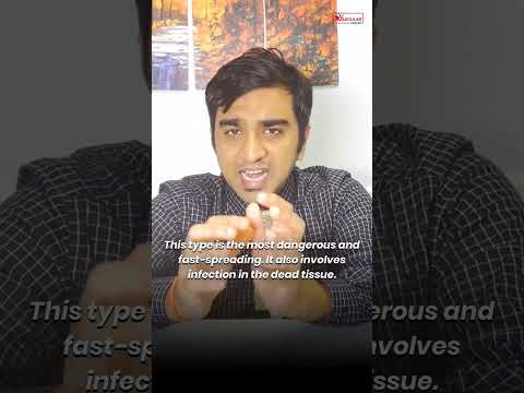 Gangrene का सबसे खतरनाक रूप – Wet Gangrene | What is WET GANGRENE