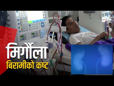 डायलसिस खर्चिलो हुँदा निःशुल्क उपचारको पालो कुरिरहेका बिरामी | Galaxy News Report