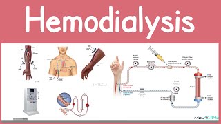Hemodialysis Explained | Indications, Procedure, Dialysis Machine, Venous Access and Nursing Care