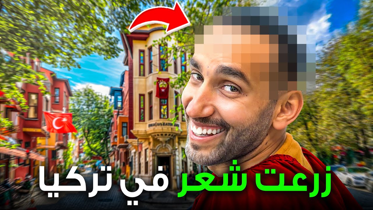 زراعة الشعر في تركيا و أماكن سياحة سرية 2026