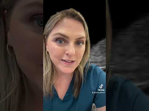 The Nuchal Translucency screening