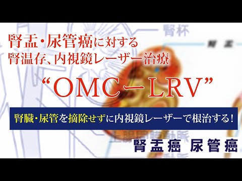 YouTube動画サムネイル
