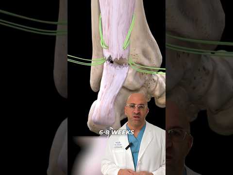 Tearing the Strongest Leg Tendon #shorts #achilles