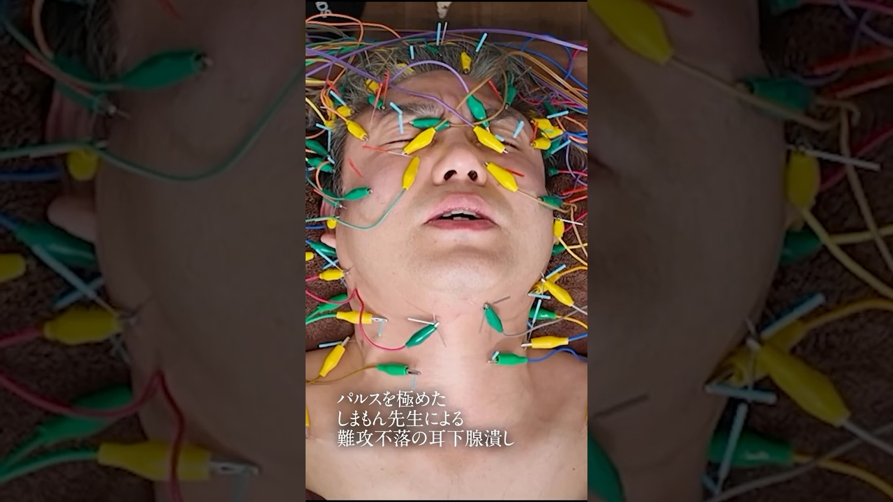 【この施術やばいよ！】ガチガチ耳下腺を触れるだけで大激痛｜多くの施術家を悩ませた詰まりに詰まったリンパ液をドバドバ大放出！ #美容 #鍼灸 #小顔 #むくみ