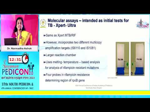 Evaluation of Tuberculosis - Recent Updates - Dr. Narmadha Ashok