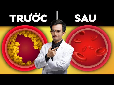 Bữa Ăn Tốt Nhất Để Làm Sạch Mạch Máu Của Bạn | Bác Sĩ Hải