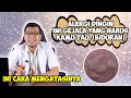 GEJALA ALERGI DINGIN YANG HARUS KAMU TAU BIDURAN DAN CARA MENGATASINYA DOKTER SADDAM ISMAIL