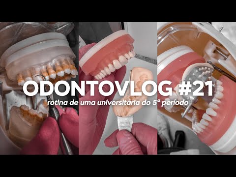ODONTOVLOG #21: uma semana prática: perio, dentística e prótese | Odonto Energy