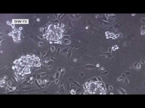 Projekt Zukunft | Stammzellen aus Hoden