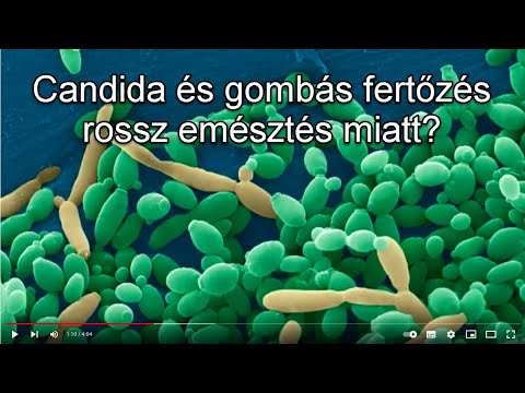 Candida paraziták tünetei