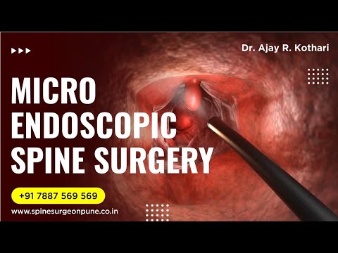 Key hole spine surgery , Minimally invasive spine surgery