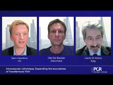 Intravascular Lithotripsy: Expanding the boundaries of Transfemoral TAVI - PCR London Valves 2021
