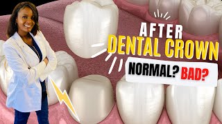 What is Normal after Starting a Dental Crown? Pain, Sensitivity should you worry?