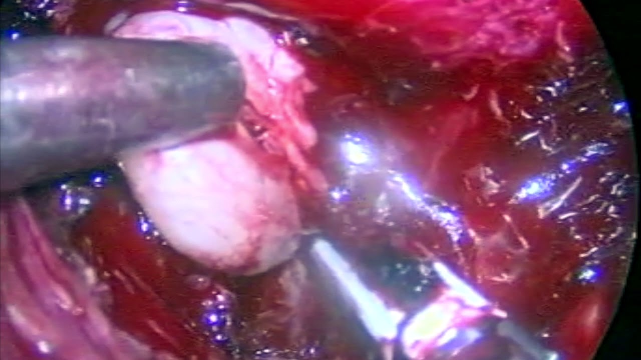 Josias Rodrigues Westphal-8