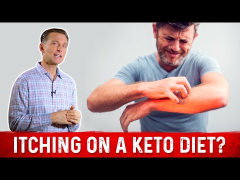 What is a Ketone Explained By Dr Berg
