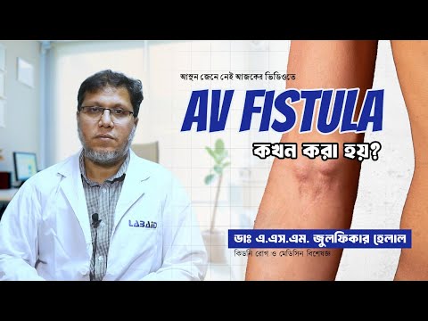 When is AV Fistula Surgery Needed for Kidney Patients?