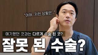 코 수술했는데 모양이 더 이상해요ㅠㅠ 망한건가요..?