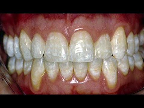 download lagu mp3 mp4 Smart Water Warning Signs, download lagu Smart Water Warning Signs gratis, unduh video klip Smart Water Warning Signs