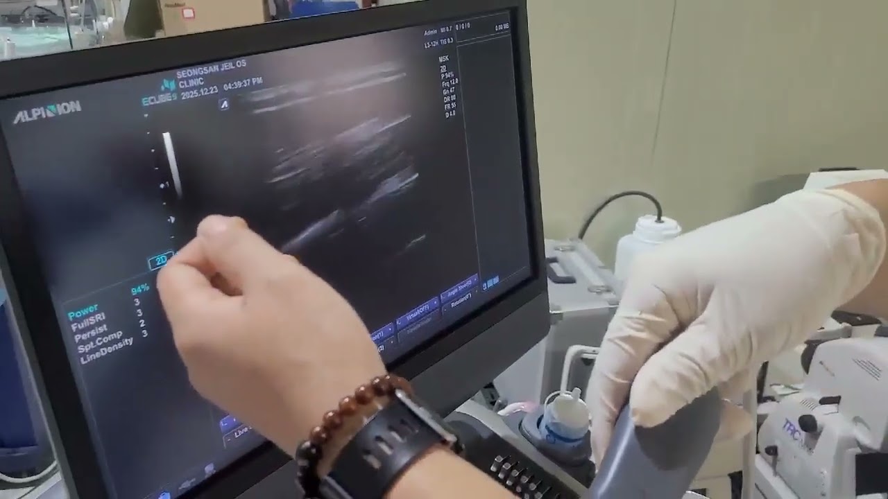 Alpinion SC1-6 Convex Probe video