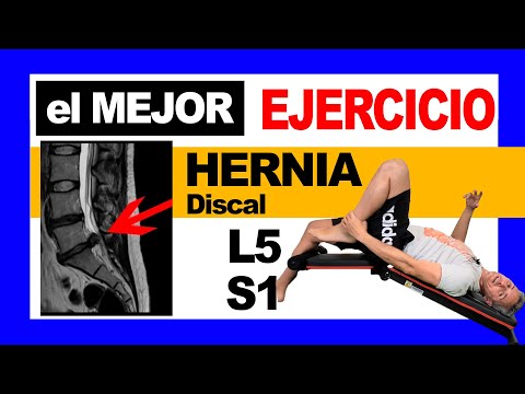 ✅The BEST Exercise for L5-S1 Disc Herniation