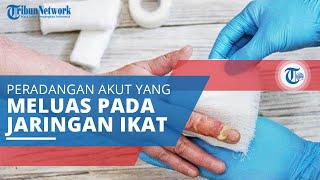 Phlegmon, Suatu Peradangan Akut yang Meluas pada Jaringan Ikat dan Jaringan Lunak