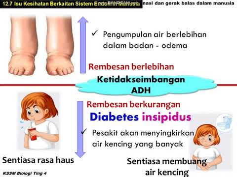 BIOLOGI TINGKATAN 4 : 12.7 ISU KESIHATAN BERKAITAN SISTEM ENDOKRIN MANUSIA