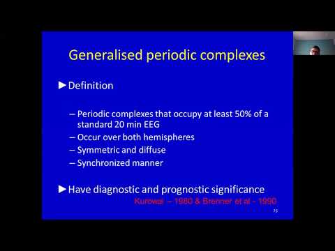  EEG -Generalised Periodic Discharges - Dr Sujit Jagtap