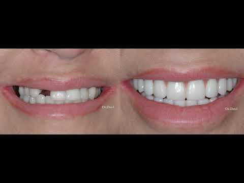 Patient Testimonial 15