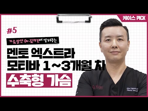 뾰족가슴이라 불리는 수축형 가슴 | 겨절로 개선한 케이스 리뷰 | 윈느성형외과 | 윈느성형외과 라벨윈느 유튜브 영상