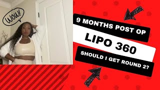 9 Months Post Op- Lipo 360|Dr. Cliff Cannon|Should I get another round of Lipo