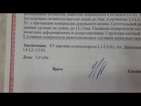 Мышцы спины грудной отдел травмы Локализация болей при остеохондрозе