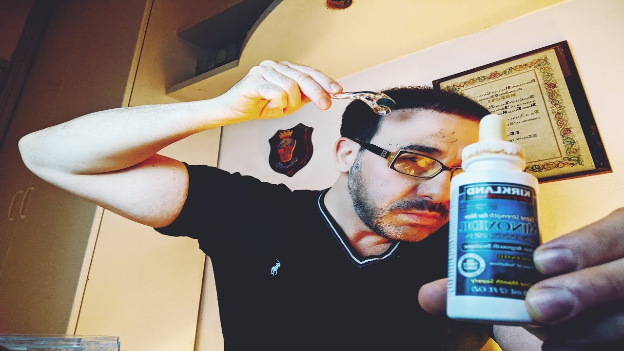 DERMAROLLER PER IL CUOIO CAPELLUTO :video TUTORIAL