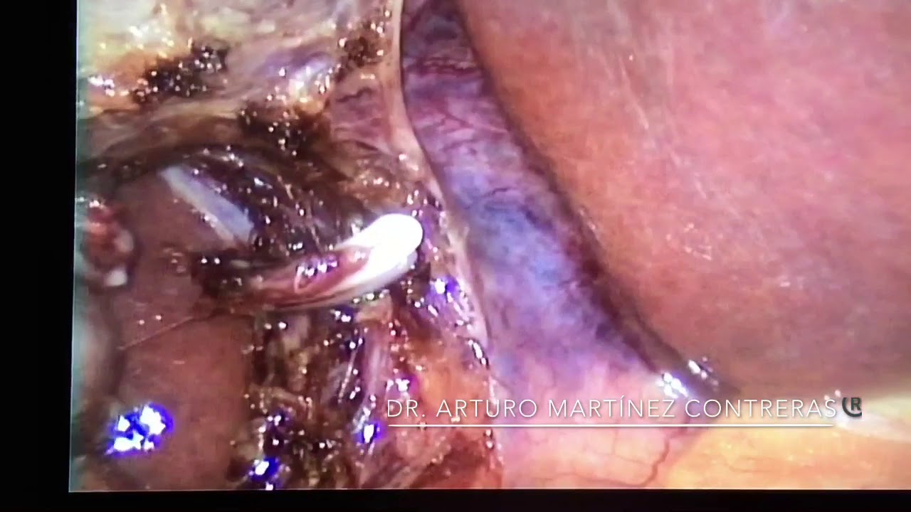 Arturo Martínez Contreras-11