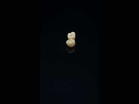 YouTube 썸네일