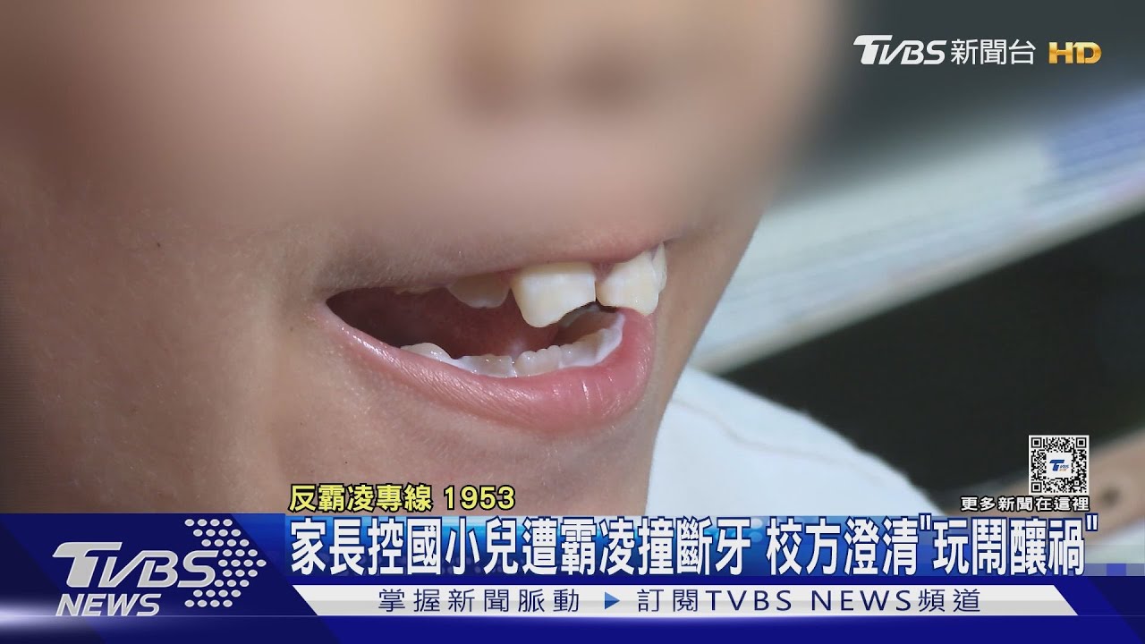 家長控國小兒遭霸凌撞斷牙!校方澄清「玩鬧釀禍」