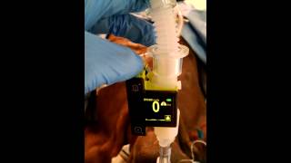 End Tidal CO2 production in a Cadaver after 25 minutes of ventilation