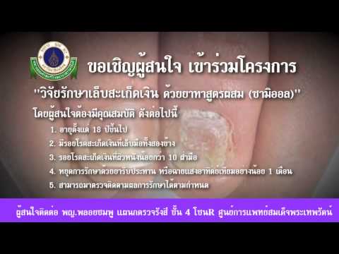เมื่อมันแพ้โรคสะเก็ดเงิน ตัวแทนจาก Sophora โรคสะเก็ดเงิน