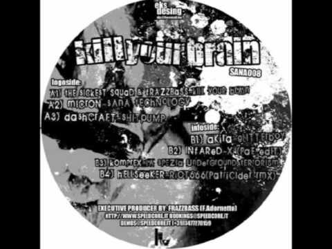 The Sickest Squad & Frazzbass - Kill your brain