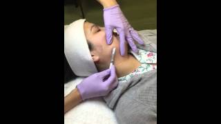 Dermaplane Resurfacing