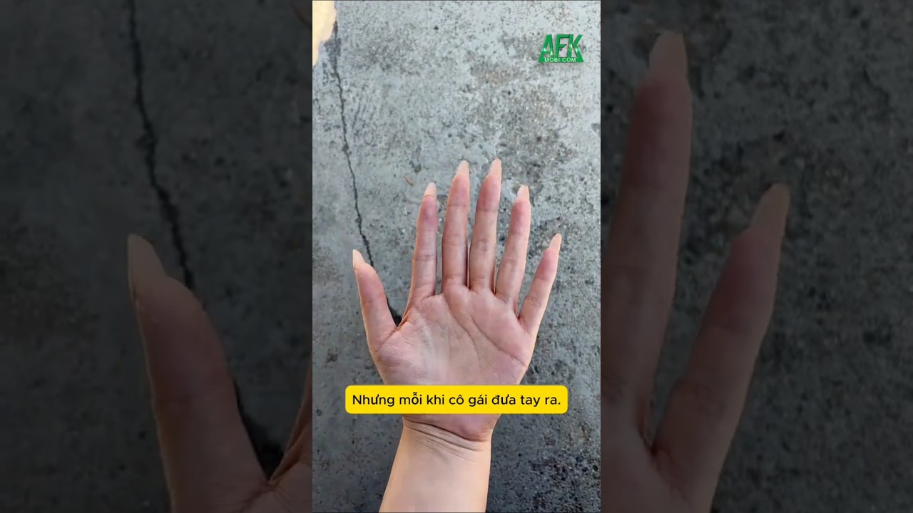 Điều gì xảy ra khi bạn sở hữu bàn tay có 6 ngón?