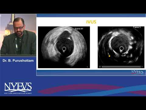 Case 2 Bhaskar Purushottam Session VI Complications and bailouts let's celebrate great escape or dro