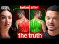 The SHOCKING Link Between Creatine & Dementia