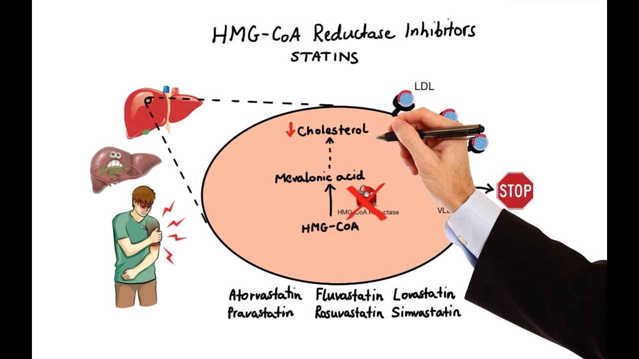 Pharmacology - DRUGS FOR HYPERLIPIDEMIA (MADE EASY)