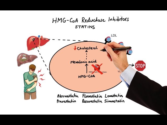 Vidéo Prononciation de Ezetimibe en Anglais