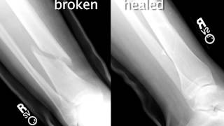 Polyelectrolyte Multilayers